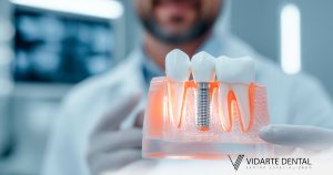 Dental Implants Are they right for me?