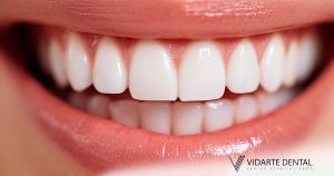 What is a periodontist
