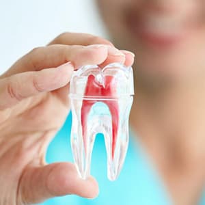Endodoncia en Málaga - Endodoncias multirradiculares