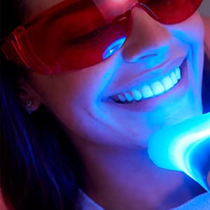Blanqueamiento dental en Málaga con Philips Zoom