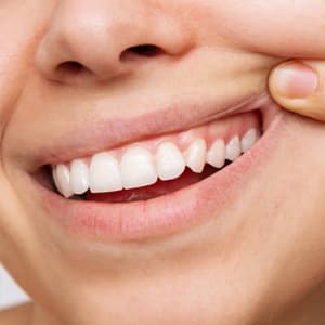 La Periodontitis
