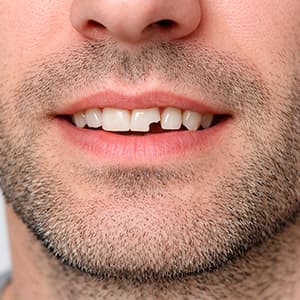 Urgencias Dentales